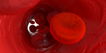 Anemi (kansızlık) nedir, neden olur? Belirtileri ve tedavisi