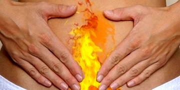 Geçmeyen mide yanması, en önemli mide kanseri belirtisi