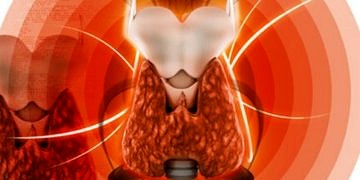 Tiroid nodüllerine yaklaşım