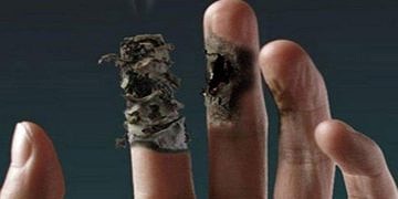 Buerger hastalığı tanı ve tedavisi