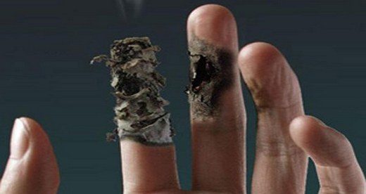 buerger-hastalığı