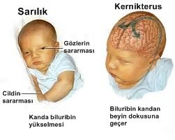 YD-sar%C4%B1l%C4%B1k.jpg