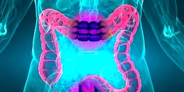 Kolit nedir? Neden olur? Kolitin belirtileri ve tedavisi