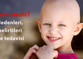 Lösemi nedir, neden olur? Belirtileri, türleri ve tedavi yöntemleri