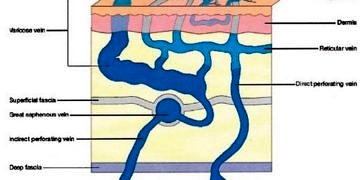 Venöz sistem hastalıkları tanı ve tedavisi