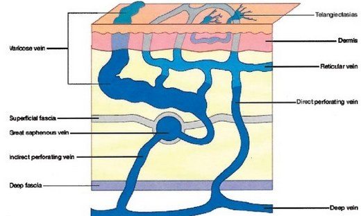 Venöz sistem hastalıkları