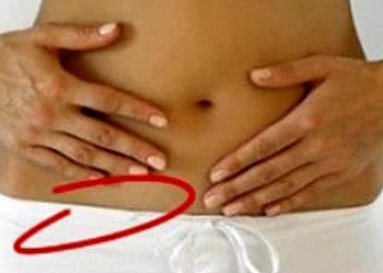 Apandisit nedir? Apandis hangi taraftadır? Belirtileri ve tedavisi