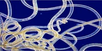 Bağırsak parazitleri (kıl kurdu-tenya) nasıl dökülür? Belirtileri ve tedavisi