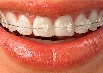 Ortodonti nedir?