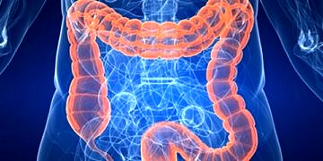 Cerrahi, kolon kanseri tedavisinde üstünlüğünü koruyor!