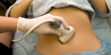 Yumurtalık (over) kisti nedir? Nedenleri, belirtileri ve tedavisi