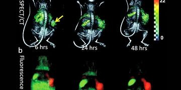 Floresan nanoproblar tümörlerin teşhisi için evrensel yöntem haline gelebilir!