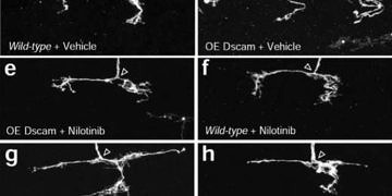 Kullanımda olan bir kanser ilacı ile down sendromunu tedavi edilebilecek!