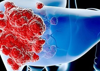 Karaciğer kanserinin ilerlemesine neden olan klit bir unsur keşfedildi