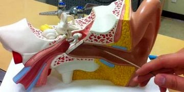 Otoskleroz nedir, tanısı ve tedavisi