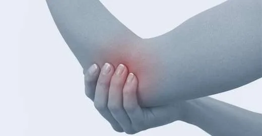 Lateral Epikondilit Tenisci Dirsegi Hastaligi Nedir Belirtileri Ve Tedavisi