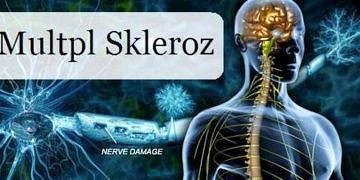 Multipl Skleroz (MS) hastalığı neden olur? Belirtileri ve tedavisi