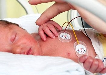 Erken sodyum takviyesi prematüre bebekler için çok yararlı olabilir