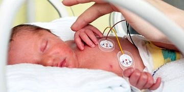 Erken sodyum takviyesi prematüre bebekler için çok yararlı olabilir