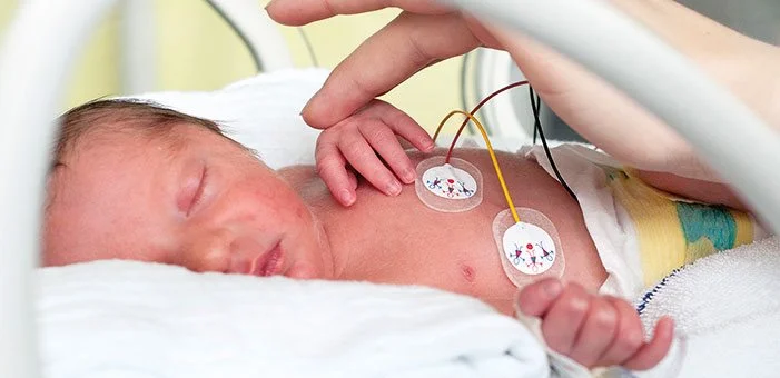 Yenidogan Bebek Sariligi Nedir Belirtileri Ve Tedavi Yontemleri