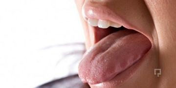 Ağızda yanma ve glossalgia nedir? Nedenleri ve tedavisi