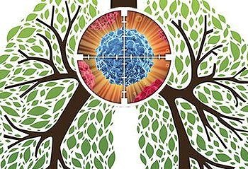 Küçük hücreli dışı akciğer kanserinde hedefleyici tedaviler