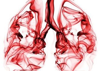 Türkiye’de akciğer kanserinin yaygınlığı, seyri ve tanı yöntemleri…