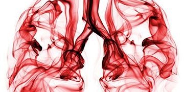 Türkiye’de akciğer kanserinin yaygınlığı, seyri ve tanı yöntemleri…