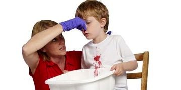 Çocuklarda burun kanaması neden olur? Nasıl durdurulur?