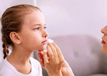 Çocuklarda burun kanaması neden olur? Nasıl durdurulur?