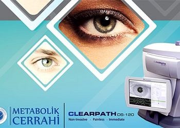 Göz taraması ile 6 saniyede diyabet teşhisi yapılabilecek