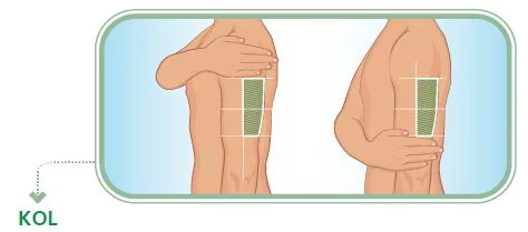 Insulinler Ve Insulin Kullanim Teknikleri Rehberi