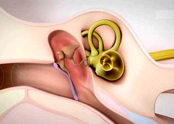 Ototoksisite nedir, tedavisi ve ototoksisite yapan ilaçlar