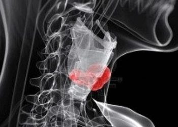 Larenks hastalıklarında belirtiler ve tanı