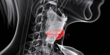 Larenks hastalıklarında belirtiler ve tanı