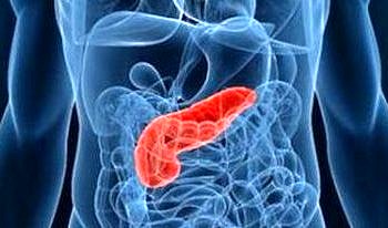 Pankreas iltihabı (akut pankreatit) nedenleri