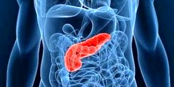 Pankreas iltihabı (akut pankreatit) nedenleri
