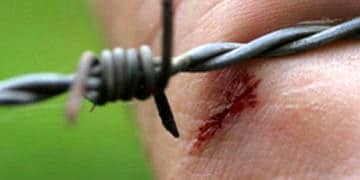 Tetanos nedir? Nasıl bulaşır? Belirtileri, tedavisi ve tetanoz aşısı