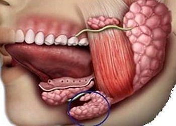 Tükürük bezlerinin şişmesinin yarattığı sorunlar ve tedavisi