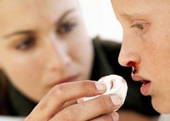 Sıcak havada burun kanamasına karşı 9 bilimsel öneri