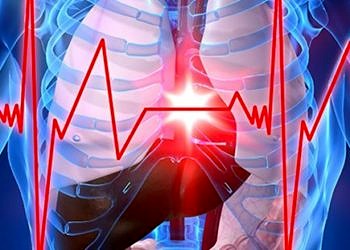 Hastanede yatan hastalarda kalp krizleri nedeniyle ölüm oranı daha yüksek