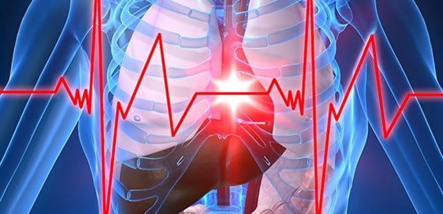 kalp-krizi-sekil