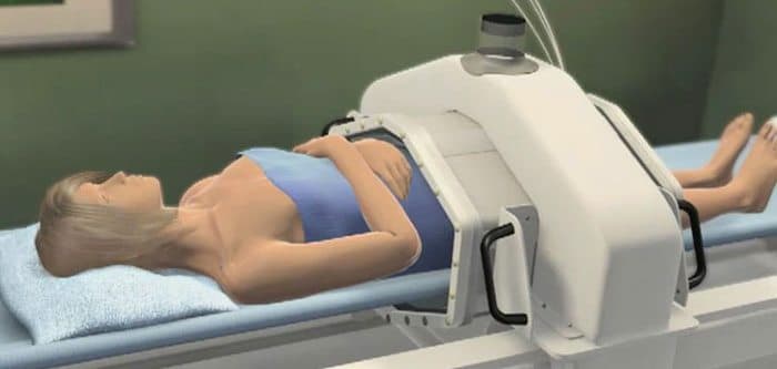 kanser-isi-hipertermi