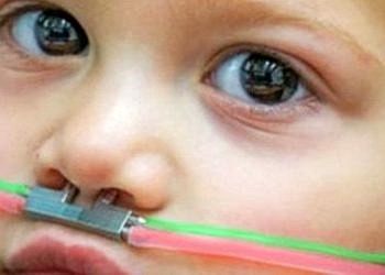 Koklama testiyle otizm teşhisi artık mümkün olacak