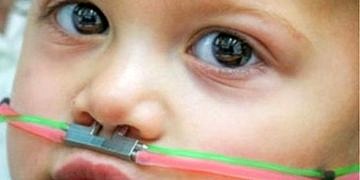 Koklama testiyle otizm teşhisi artık mümkün olacak