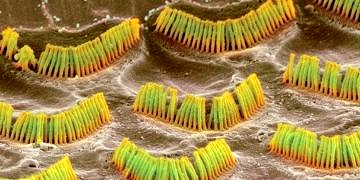 Heyecan yaratan keşif: Virüsle sağırlık tedavisinde önemli bir eşik aşıldı