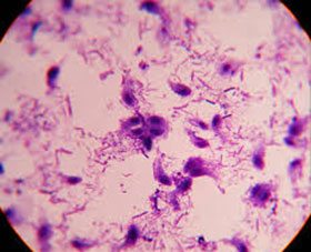 dientamoebiasis-mikrop