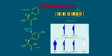 Fenilketonüri (PKU) nedir? Nedenleri, belirtileri, tedavisi ve diyeti