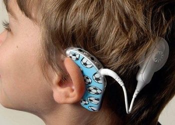 İşitme kaybı tedavisinde kullanılan Koklear İmplant nedir?