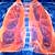Akciğer kanserinde başarı doğru hastaya doğru tedavi ile mümkün